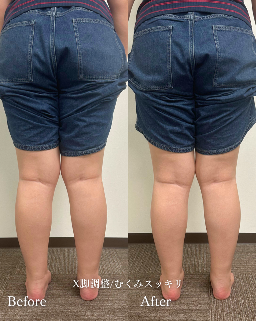 札幌足つぼ整体