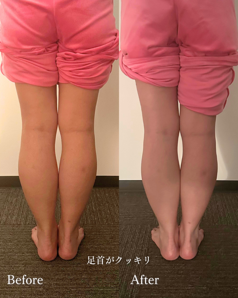 札幌足つぼ整体